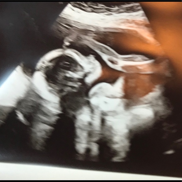 Meet Your Posher! - Picture 5 of 5